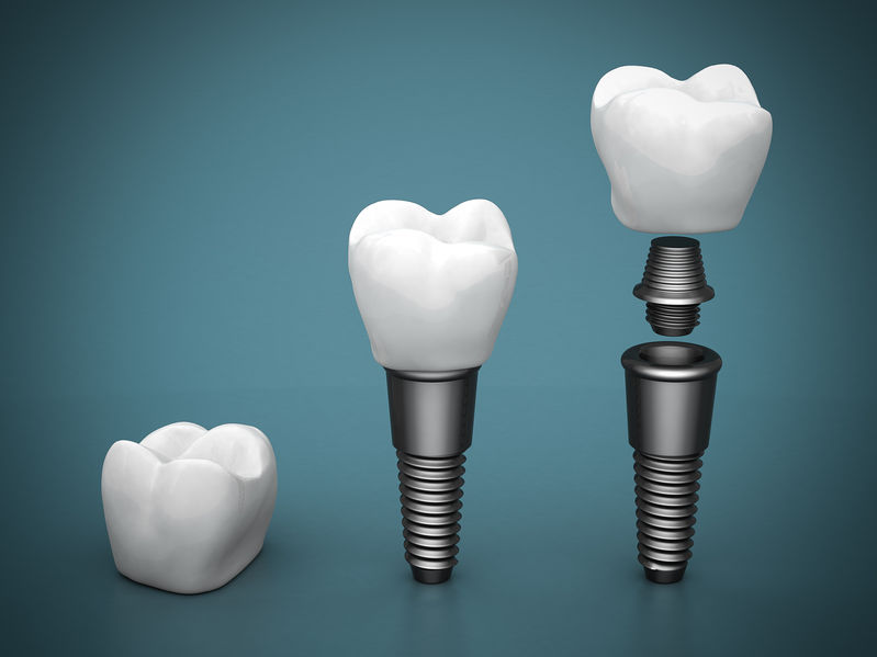 Cosmetic Dentistry