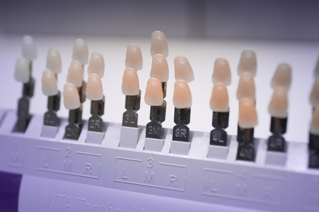Cosmetic Dental Bonding