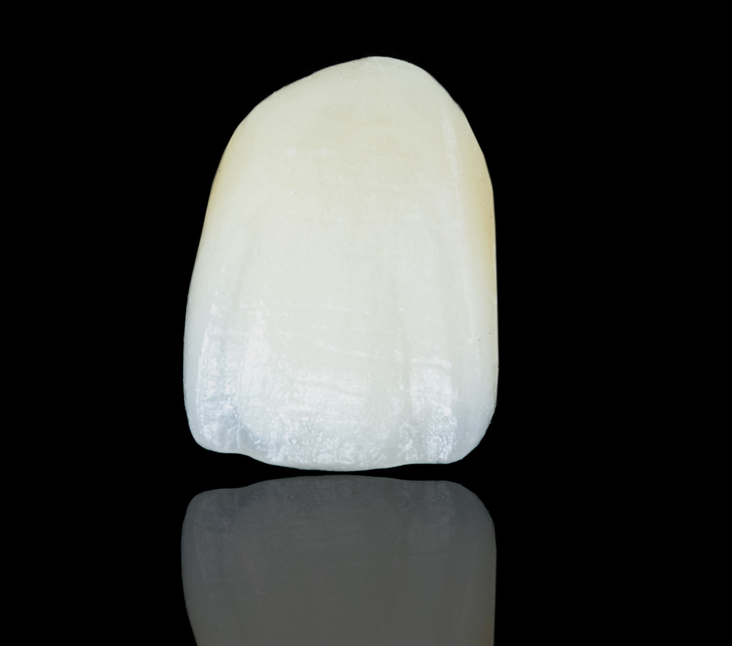 Cosmetic Dental Bonding