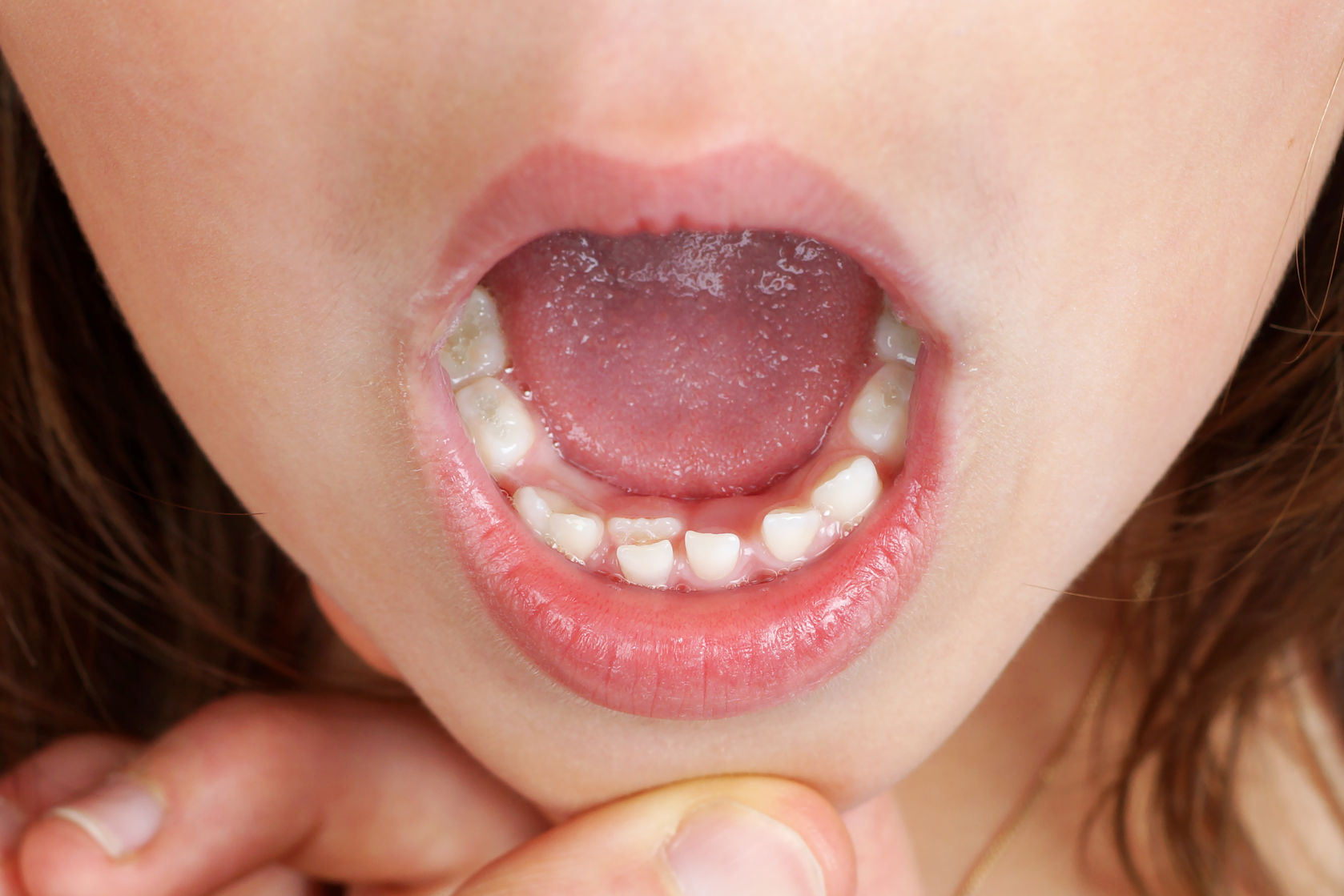 Family Dentistry