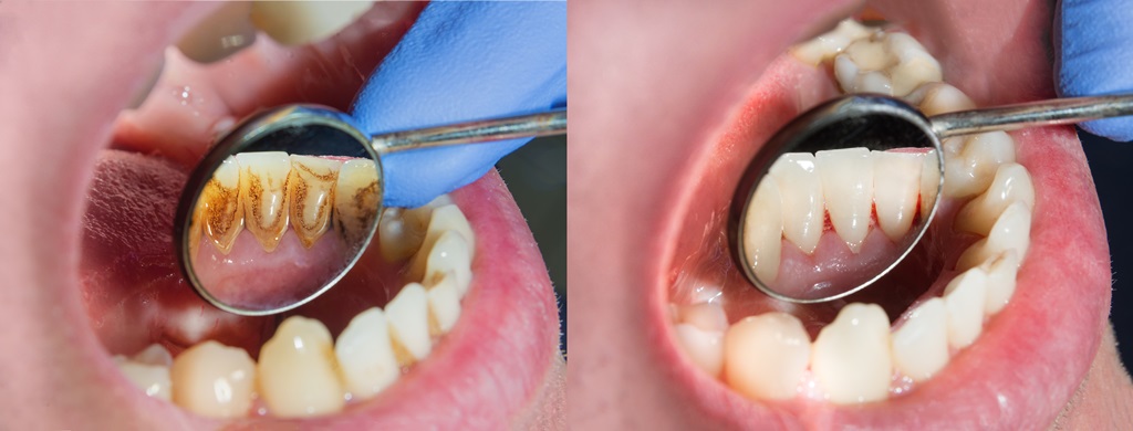 General Dentistry