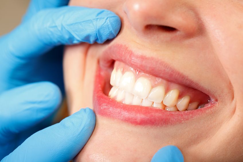 Gum Disease
