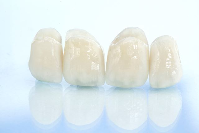 Porcelain Veneers