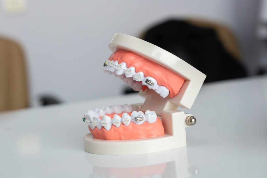 tooth bonding benefits